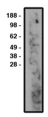 "
Western blot using nSMase2 antibody (Cat. No. X2360P) on human brain lysate (Cat. No. X1633C).  Lysate used at 14 µg/lane.  Antibody used at 10 µg/ml.  Secondary antibody, mouse anti-rabbit HRP (Cat. No. X1207M), used at 1:50k dilution. "